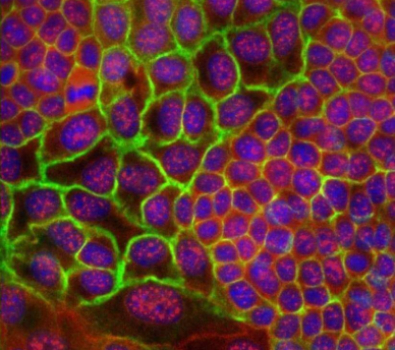 Blog Main Image - Scientific Cells Mammary Gland Cancer Associated Molecules