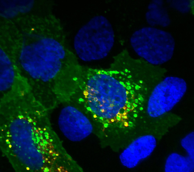 News LITAF CD63 DNA