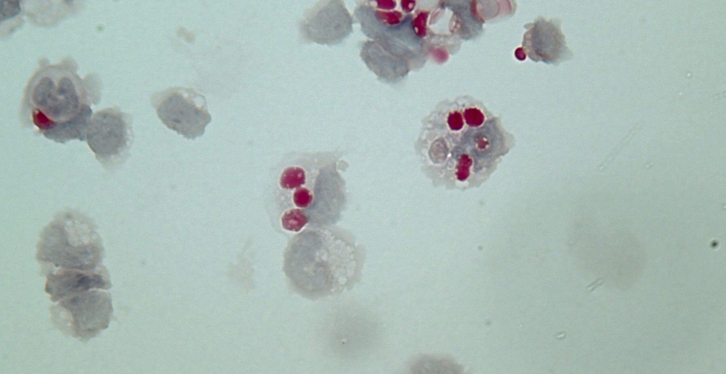 Meermand Lab Hamerman Lab | Benaroya Research Institute